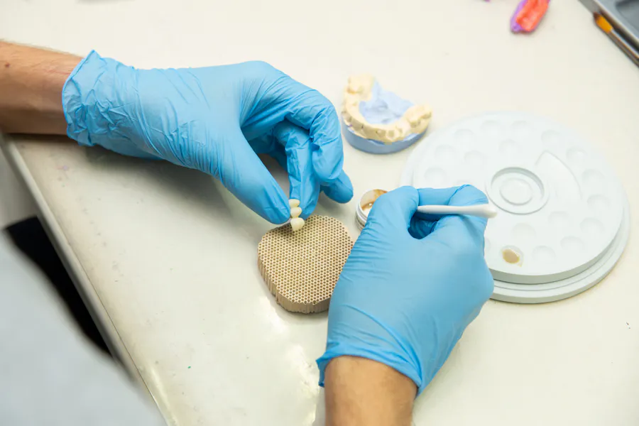 Implantes dentales en Las Palmas de Gran Canaria